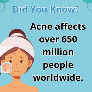 Acne affects over 650 million people worldwide.